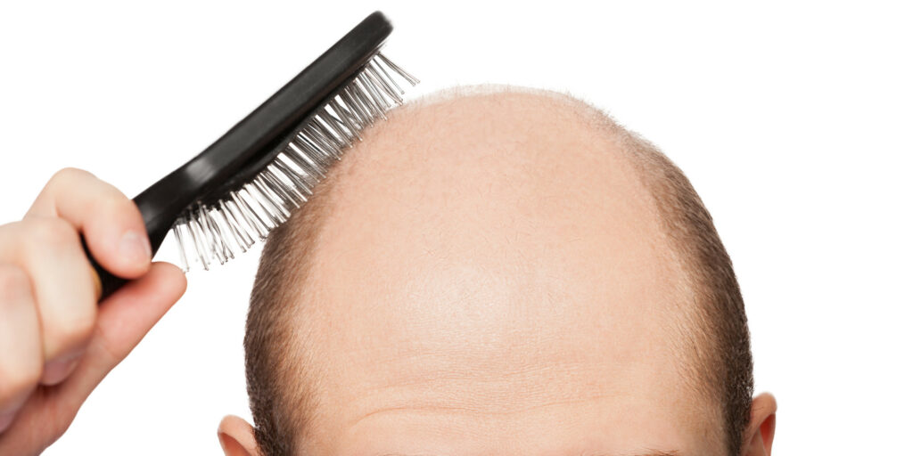 Reasons For Hair Fall In Men