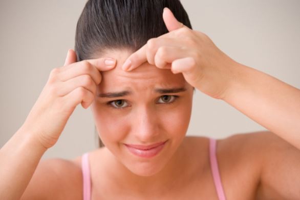 3 Easy and Natural Ways To Remove Pimples