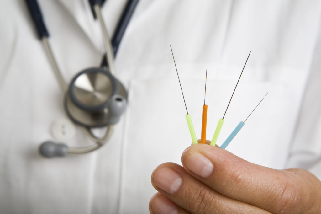 Things You Should Know As A Professional Doctor Of Acupuncture