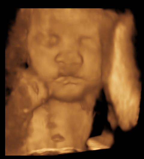 Getting To Know 3D and 4D Ultrasound Technology