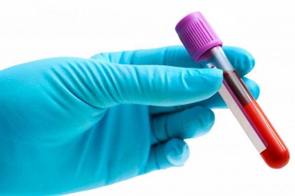 How Accurate Are Blood Tests... Really?