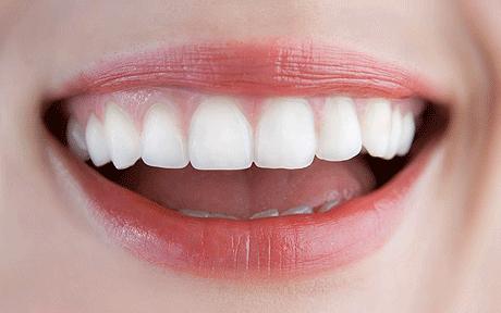Zoom Whitening – A Reliable Solution In Permanent Teeth Whitening