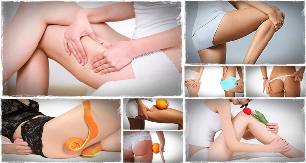 4 Natural Treatments To Get Rid Of Cellulite