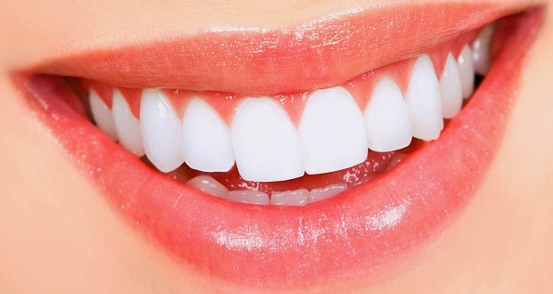 Teeth whitening