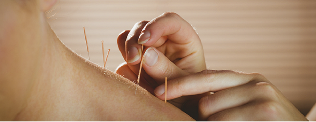 How Effectively Can Acupuncture Work For Neck & Shoulder Pain