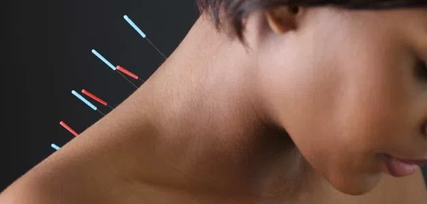 How Effectively Can Acupuncture Work For Neck &amp; Shoulder Pain