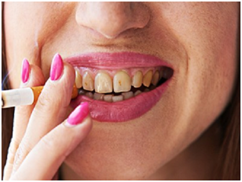 Habits You Should Quit For Healthy Teeth