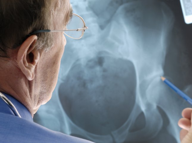 What Is To Be Expected From Total Hip Replacement Surgery?