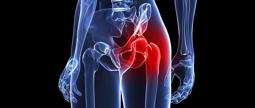 What Is To Be Expected From Total Hip Replacement Surgery?