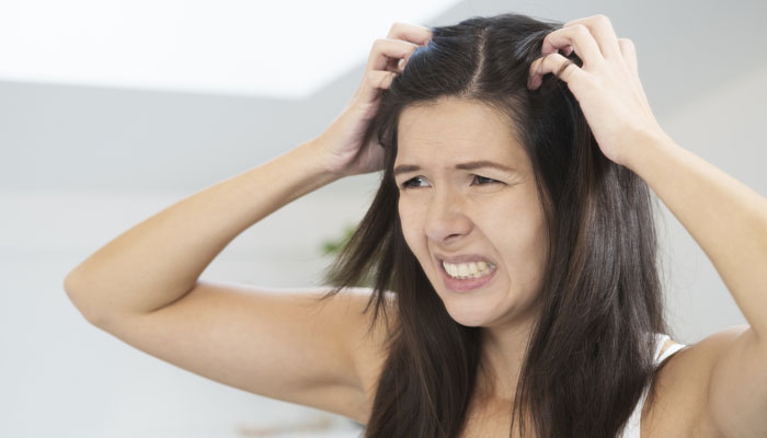 Here Are Some Best Remedies For Itchy Scalp