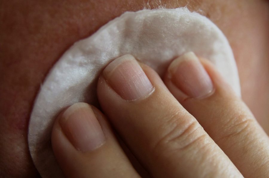 How To Handle A Bad Rash from Bad Skin Creams
